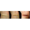 FOR736-Kit maquillage secourisme pour blessures
