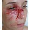 MAQUILLAGE FRACTURE DU NEZ AVEC POMETTE GONFLEE