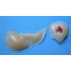 MAQUILLAGE FRACTURE DU NEZ AVEC POMETTE GONFLEE