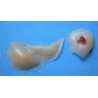 MAQUILLAGE FRACTURE DU NEZ AVEC POMETTE GONFLEE