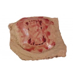Plaie morsure de chien
