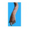 Fracture interne avant bras, tibia ou clavicule