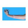 Fracture interne avant bras, tibia ou clavicule